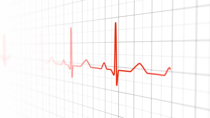 A close-up of a red electrocardiogram (ECG) waveform on a white grid background, highlighting the characteristic peaks and intervals of a heartbeat used to monitor and diagnose cardiac activity.