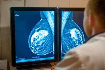 breast-image-comparison