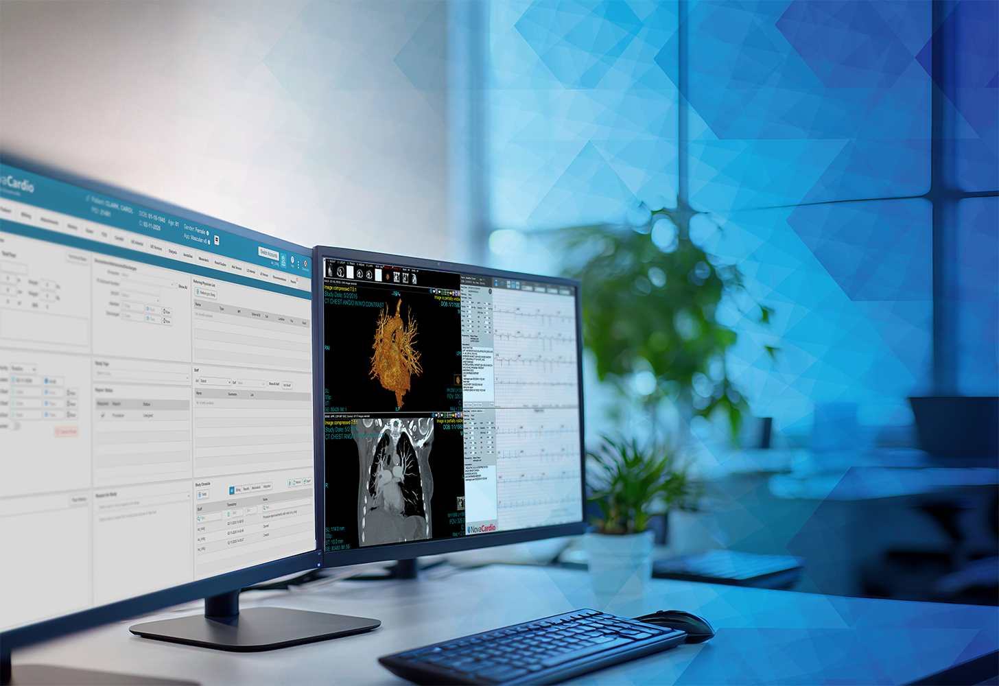 NovaCardio viewer displaying an echocardiogram with an EncaptureMD structured report
