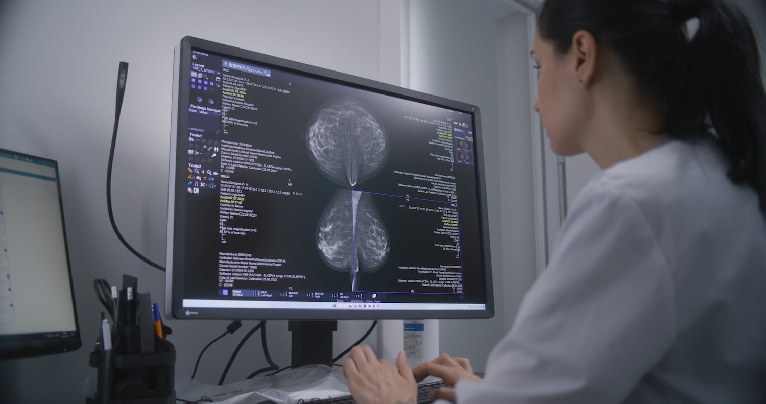 mammography radiology comparison